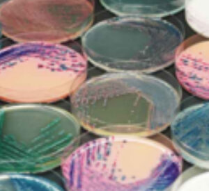 Chromogenic & standard media for microbiology testing