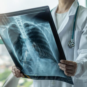 DIAGNOSTIC RADIOLOGY