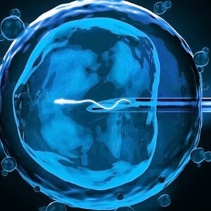 IVF