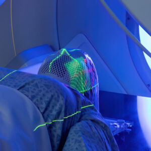 RADIOTHERAPY